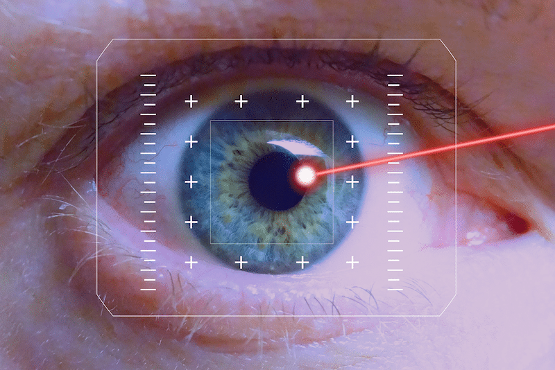 Chirurgie oculaire au laser